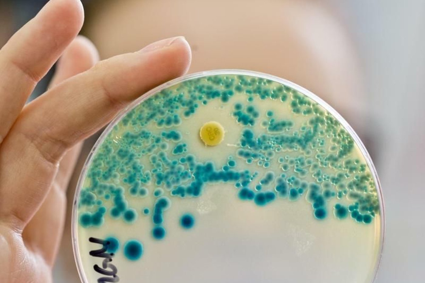 Antibiotika: KI analysiert Resistenzen von Bakterien