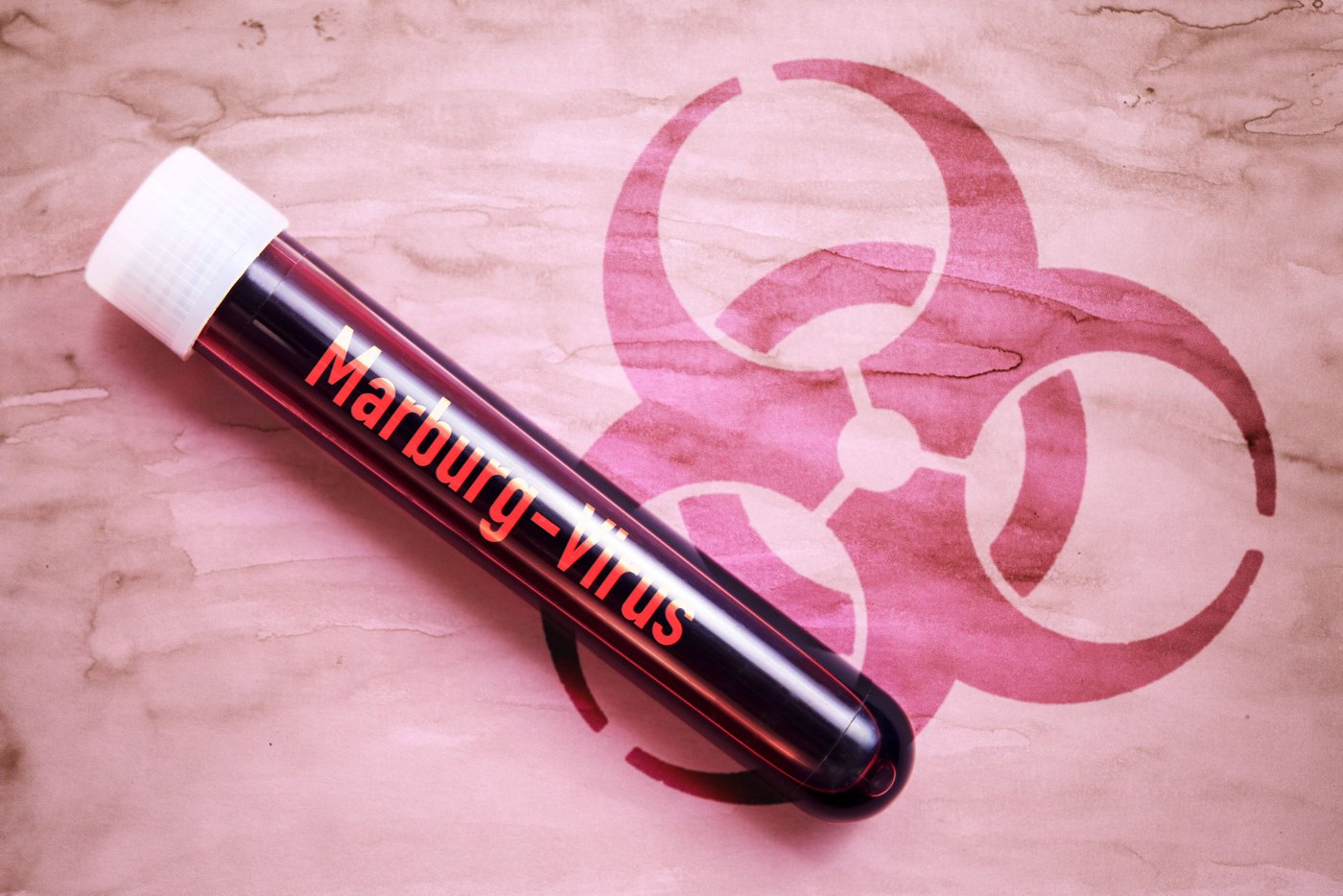 Infection: Suspected Marburg virus in Hamburg