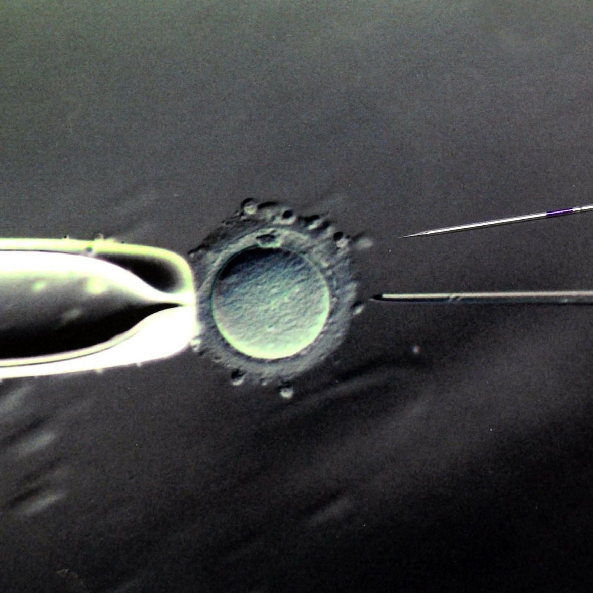 Knstliche Befruchtung: Gendiagnose an Embryos wird in der Schweiz erlaubt