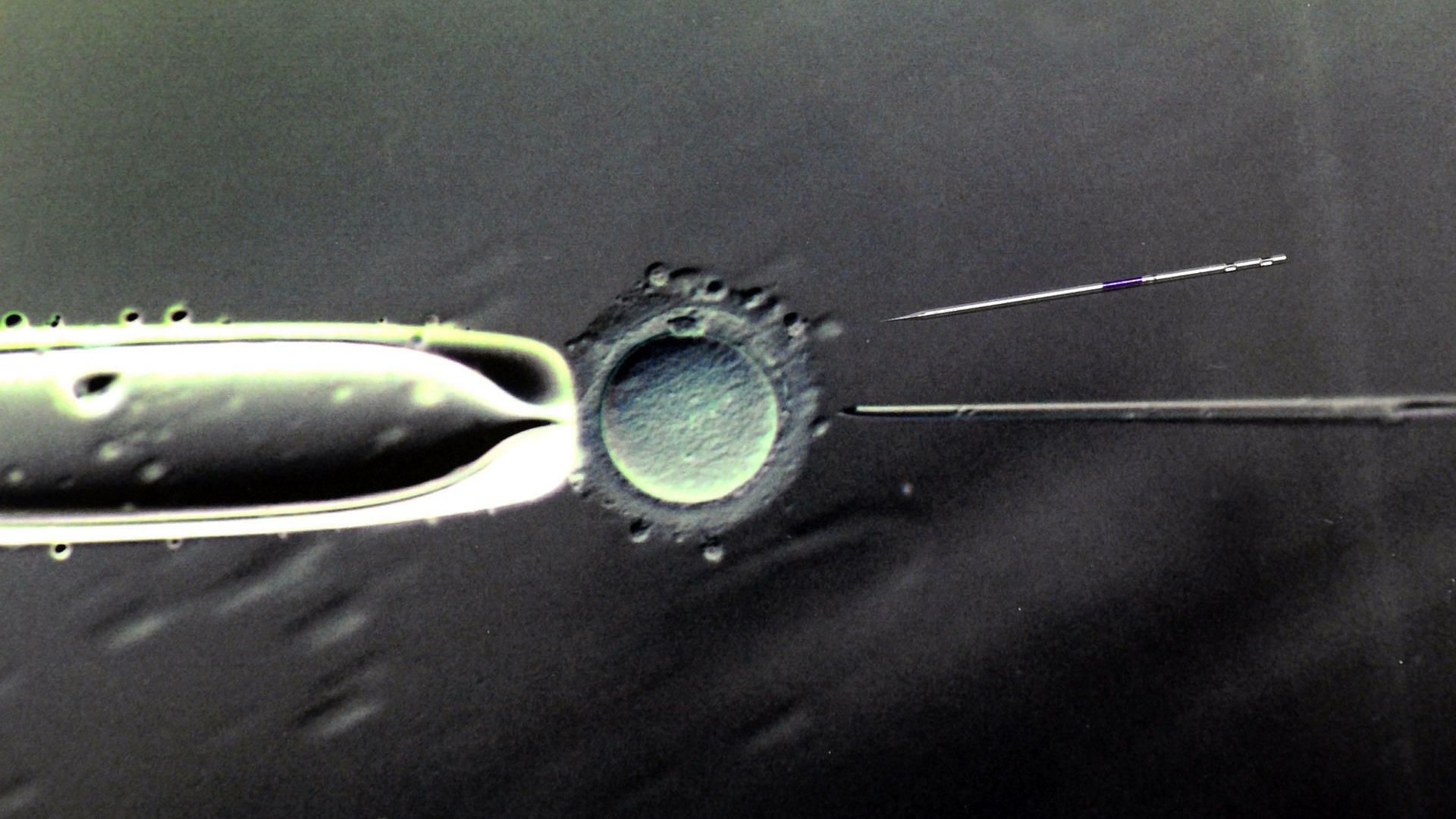 Knstliche Befruchtung: Gendiagnose an Embryos wird in der Schweiz erlaubt