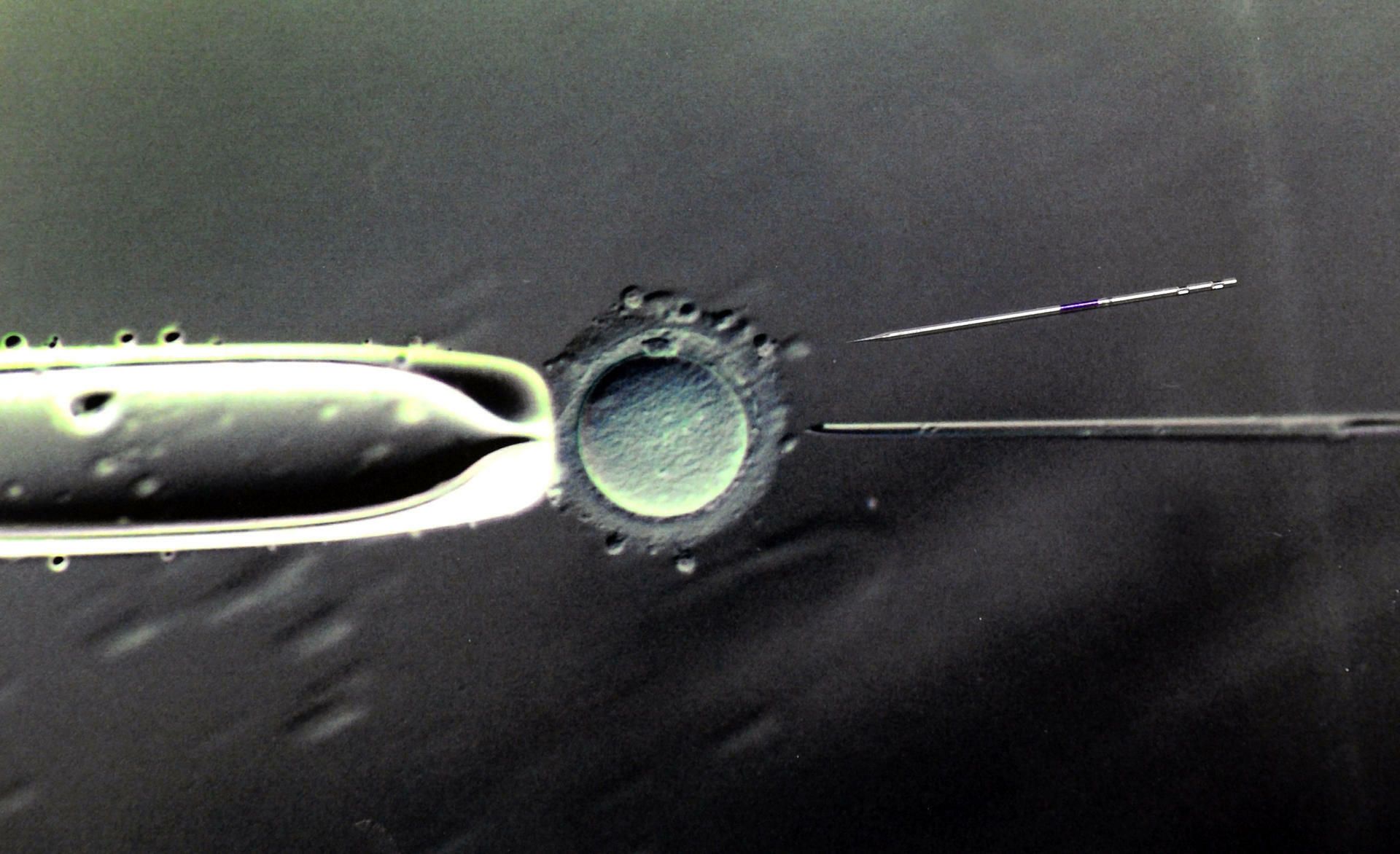 Knstliche Befruchtung: Gendiagnose an Embryos wird in der Schweiz erlaubt