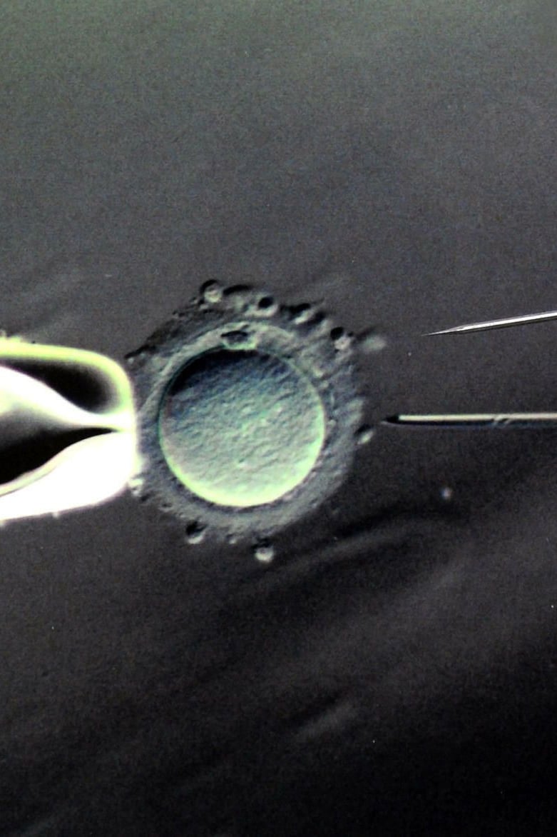 Knstliche Befruchtung: Gendiagnose an Embryos wird in der Schweiz erlaubt
