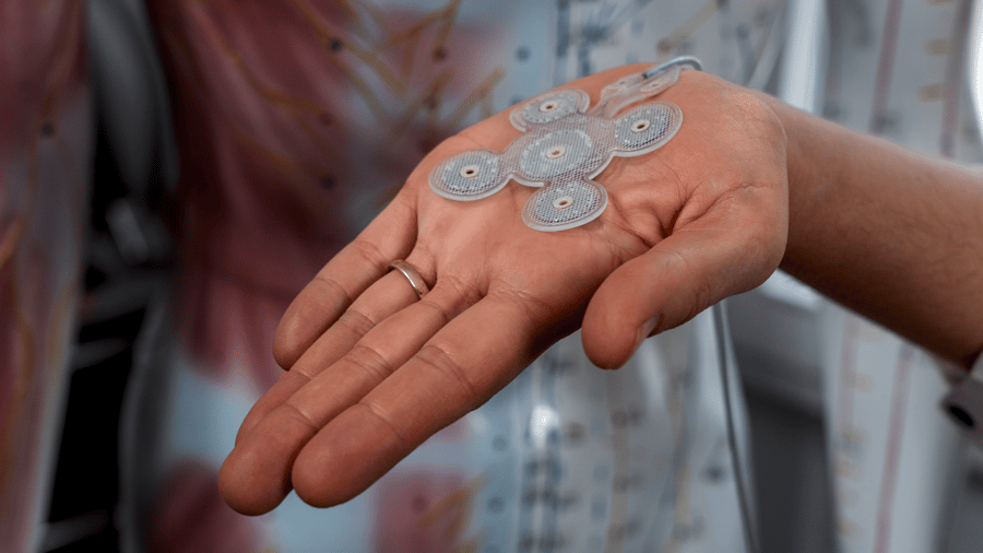 Start-up Precisis: 20 Millionen Euro für Hirnstimulation ohne Schädelöffnung