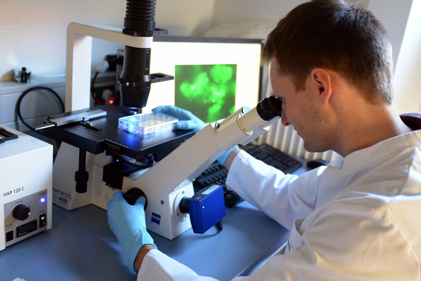Bayer Vor Entscheidender Phase: Hoffnungsträger Gegen Parkinson Im Test - jtx100f