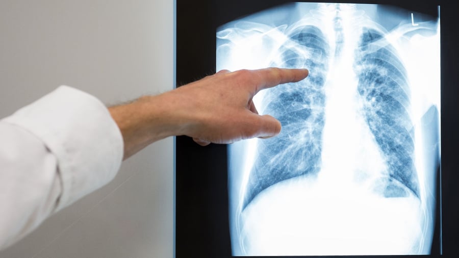 Medizin: TÜV-Bericht: Jedes achte Röntgengerät weist Mängel auf