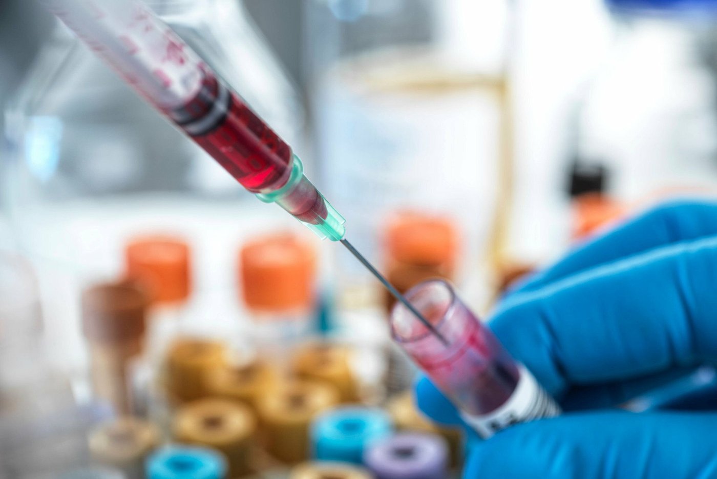 Wie Lange Dauert Rheuma Bluttest www.handelsblatt.com